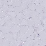 MAT1A Antibody in Immunohistochemistry (Paraffin) (IHC (P))