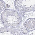 MAT1A Antibody in Immunohistochemistry (Paraffin) (IHC (P))