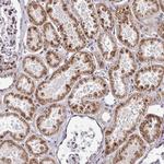 CBX7 Antibody in Immunohistochemistry (Paraffin) (IHC (P))