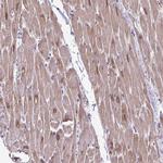 AKAP6 Antibody in Immunohistochemistry (Paraffin) (IHC (P))