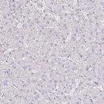 AKAP6 Antibody in Immunohistochemistry (Paraffin) (IHC (P))