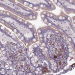 LTB Antibody in Immunohistochemistry (IHC)