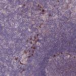 LTB Antibody in Immunohistochemistry (IHC)