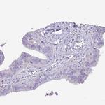 ABHD17C Antibody in Immunohistochemistry (Paraffin) (IHC (P))