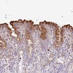 ABHD17C Antibody in Immunohistochemistry (Paraffin) (IHC (P))