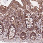 MFNG Antibody in Immunohistochemistry (IHC)