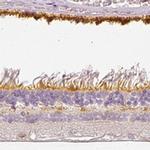 MYO3A Antibody in Immunohistochemistry (IHC)