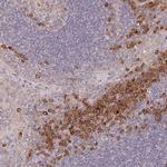 DERL2 Antibody in Immunohistochemistry (Paraffin) (IHC (P))