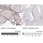 DERL2 Antibody in Immunohistochemistry (IHC)