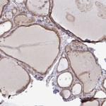 DERL2 Antibody in Immunohistochemistry (IHC)