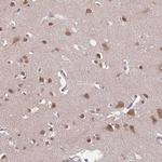 TFAP2D Antibody in Immunohistochemistry (Paraffin) (IHC (P))