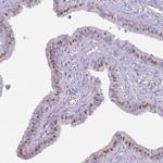 RFX2 Antibody in Immunohistochemistry (Paraffin) (IHC (P))