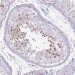 RFX2 Antibody in Immunohistochemistry (Paraffin) (IHC (P))