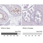 RFX2 Antibody in Immunohistochemistry (IHC)