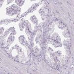 RFX2 Antibody in Immunohistochemistry (IHC)