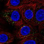 SGSM3 Antibody in Immunocytochemistry (ICC/IF)