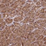 SGSM3 Antibody in Immunohistochemistry (Paraffin) (IHC (P))