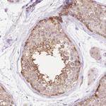 LIPH Antibody in Immunohistochemistry (Paraffin) (IHC (P))