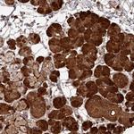 CPSF4 Antibody in Immunohistochemistry (Paraffin) (IHC (P))