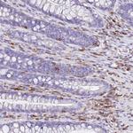 Calponin 2 Antibody in Immunohistochemistry (Paraffin) (IHC (P))