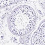 Calponin 2 Antibody in Immunohistochemistry (Paraffin) (IHC (P))