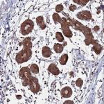 DGKD Antibody in Immunohistochemistry (Paraffin) (IHC (P))