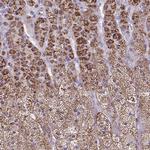 CYP11B2 Antibody in Immunohistochemistry (Paraffin) (IHC (P))