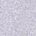 CYP11B2 Antibody in Immunohistochemistry (Paraffin) (IHC (P))