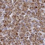 CYP11B2 Antibody in Immunohistochemistry (IHC)