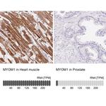 MYOM1 Antibody in Immunohistochemistry (IHC)