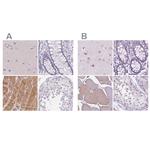 MYOM1 Antibody in Immunohistochemistry (IHC)