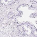 MYOM1 Antibody in Immunohistochemistry (IHC)