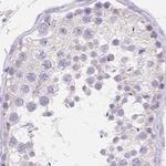 MYOM1 Antibody in Immunohistochemistry (IHC)