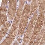 MYOM1 Antibody in Immunohistochemistry (IHC)