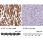 MYOM1 Antibody