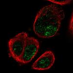 SLC16A9 Antibody in Immunocytochemistry (ICC/IF)