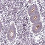 SLC16A9 Antibody in Immunohistochemistry (Paraffin) (IHC (P))