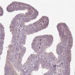 SLC16A9 Antibody in Immunohistochemistry (Paraffin) (IHC (P))