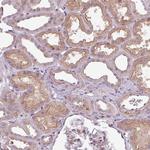 SLC16A9 Antibody in Immunohistochemistry (Paraffin) (IHC (P))