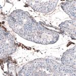 EFHD1 Antibody in Immunohistochemistry (IHC)