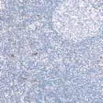 EFHD1 Antibody in Immunohistochemistry (IHC)