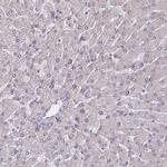 BCL9L Antibody in Immunohistochemistry (Paraffin) (IHC (P))