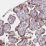 BCL9L Antibody in Immunohistochemistry (Paraffin) (IHC (P))