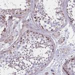 BCL9L Antibody in Immunohistochemistry (Paraffin) (IHC (P))