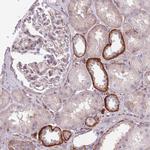 SNX6 Antibody in Immunohistochemistry (Paraffin) (IHC (P))