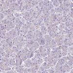 SNX6 Antibody in Immunohistochemistry (Paraffin) (IHC (P))