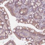 SNX6 Antibody in Immunohistochemistry (Paraffin) (IHC (P))