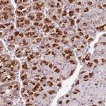 SNX6 Antibody in Immunohistochemistry (Paraffin) (IHC (P))