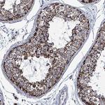 IDH3B Antibody in Immunohistochemistry (Paraffin) (IHC (P))