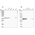 IDH3B Antibody in Western Blot (WB)